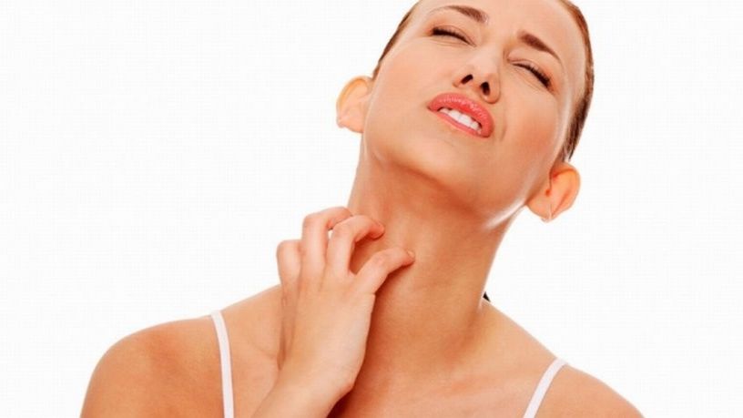 Urticaria